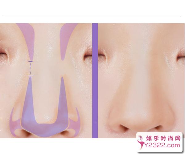  怎样才能画出小翘鼻？学会这些"套路"就可以了 