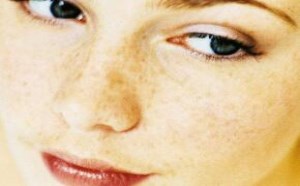 脸上长斑的原因及祛斑方法