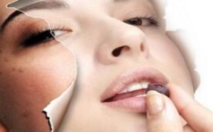 脸上长雀斑怎么办 防治雀斑的偏方