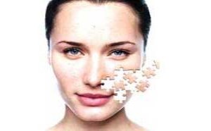 油性T区毛孔粗大如何改善 妙招分享