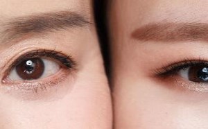 黑眼圈是什么原因造成的 去除黑眼圈的方法