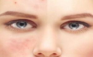 肥胖与寿命关系:肥胖者平均寿命要低于体重正常人 肥胖与寿命关系:肥胖者平均寿命要低于体重正常人