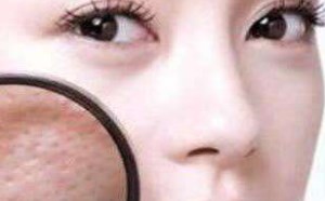 油性皮肤毛孔粗大怎么改善 收缩毛孔的方法