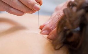 针灸减肥的原理是哪些 到底对减肥有没有效果 针灸减肥的原理是哪些 到底对减肥有没有效果